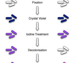 Gram Stain test