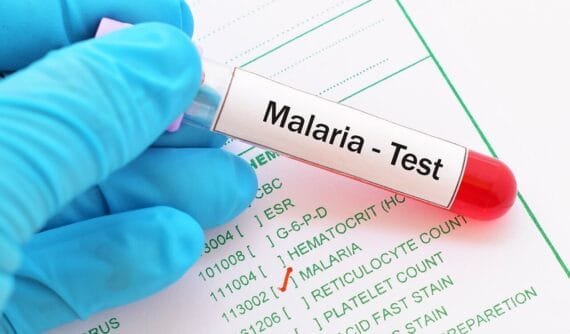 malaria-test