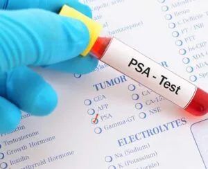 Prostate-Specific Antigen Test