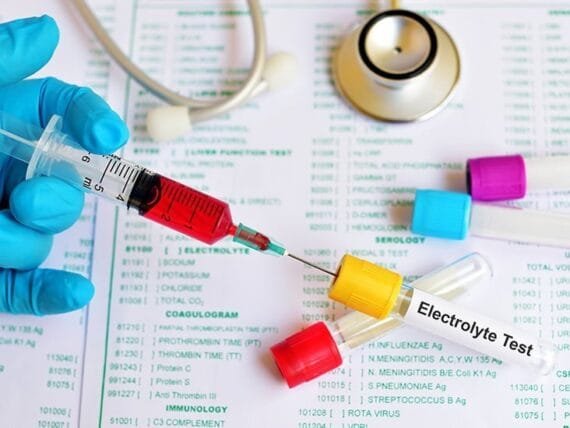 Electrolyte-test