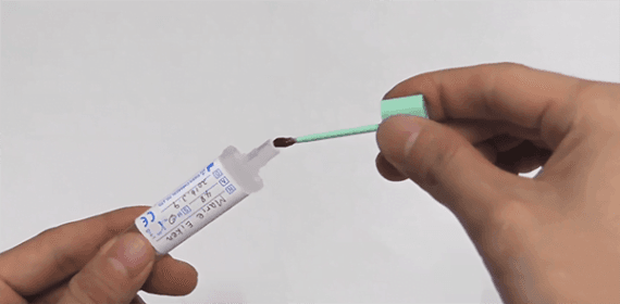 Stool Culture Test Analysis