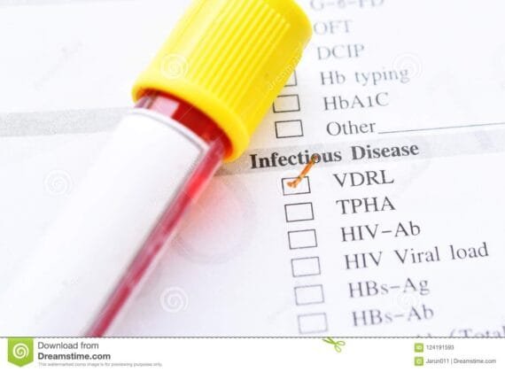 VDRL Blood test