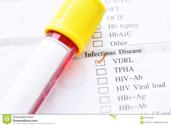 VDRL Blood test
